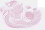 EMAGE:22567
