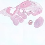 EMAGE:22587