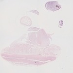 EMAGE:22627
