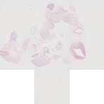 EMAGE:22627