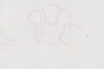 EMAGE:22627