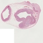 EMAGE:22696