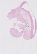 EMAGE:22707