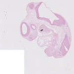 EMAGE:22707