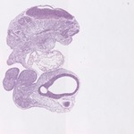 EMAGE:22728