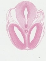 EMAGE:22741