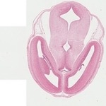 EMAGE:22741