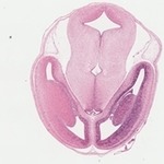EMAGE:22741