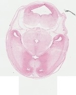 EMAGE:22741