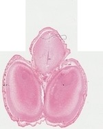 EMAGE:22744