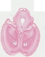 EMAGE:22744