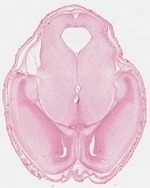 EMAGE:22744