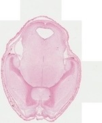 EMAGE:22744