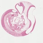 EMAGE:22745