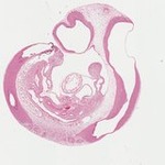 EMAGE:22745