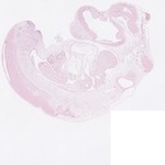 EMAGE:22751