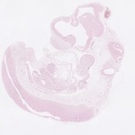 EMAGE:22751