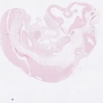 EMAGE:22751