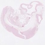EMAGE:22751