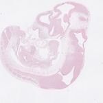 EMAGE:22751