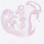 EMAGE:22751
