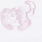 EMAGE:22751