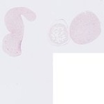 EMAGE:22762