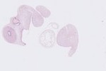 EMAGE:22762