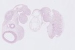 EMAGE:22762