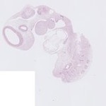 EMAGE:22762