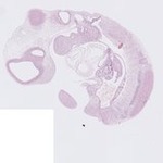 EMAGE:22762