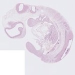 EMAGE:22762