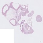 EMAGE:22762