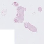 EMAGE:22762