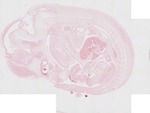 EMAGE:22853