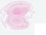 EMAGE:22868