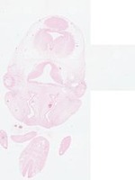 EMAGE:22870