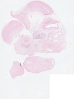 EMAGE:22871