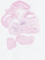 EMAGE:22871