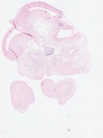 EMAGE:22871