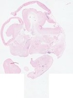 EMAGE:22871