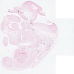 EMAGE:22871