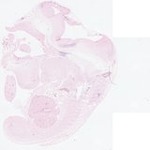 EMAGE:22871