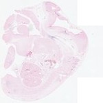 EMAGE:22871