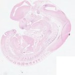 EMAGE:22871