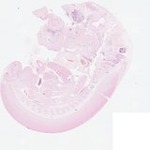 EMAGE:22871