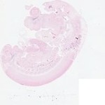 EMAGE:22871