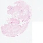 EMAGE:22871