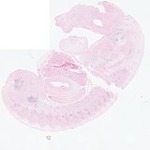 EMAGE:22871