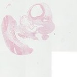 EMAGE:22886